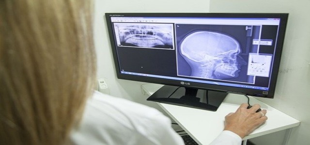 Scotland scientists develop AI-based test using X-rays to detect COVID-19